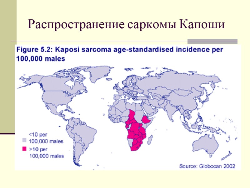 Распространение саркомы Капоши